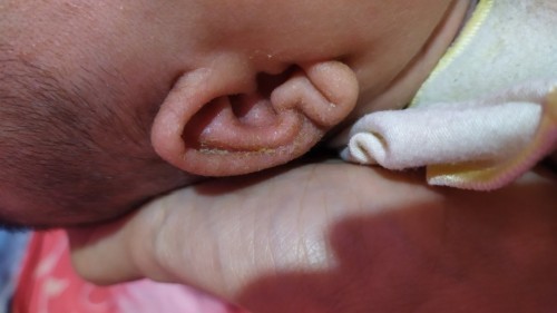 telinga bayi saya kering