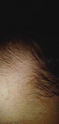 Ini biang keringat kah?