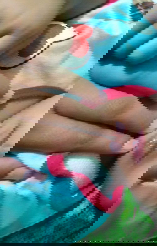 Bibir bayi agak hitam