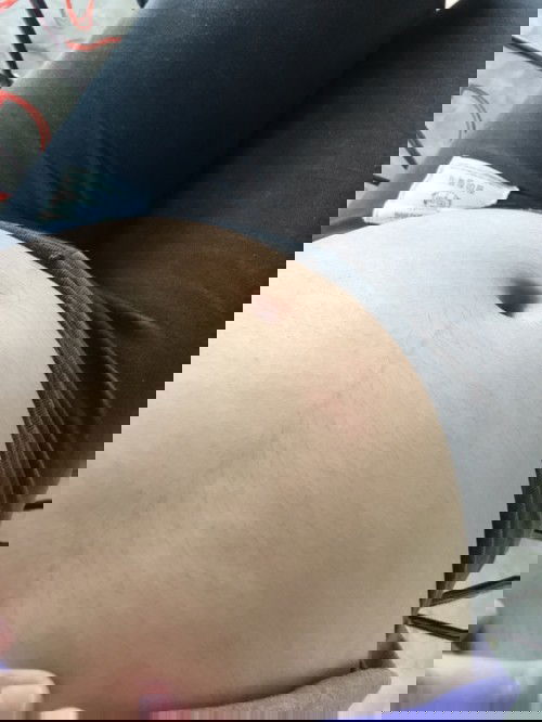 แม่ๆช่วยเดาหน่อยคร่าา ว่าน้องผู้ชายหรือผู้หญิง เพราะไปอัลตราซาวด์ น้องหนีบขาไม่ให้เห็น 😅😅 22week 3day😚