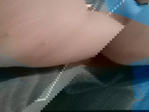 Cream buat kulit alergi susu