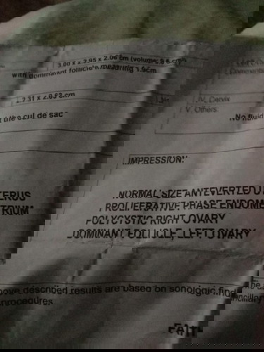 sana malaman na namin!