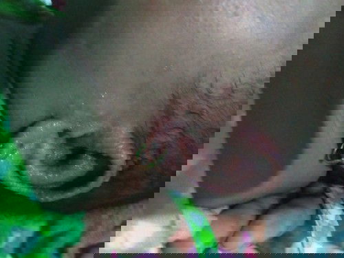 Telinga beruntus dan berair