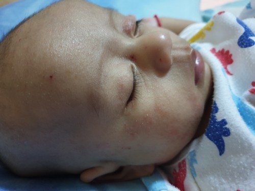 หน้าลูกผิวไม่เนียนเลย