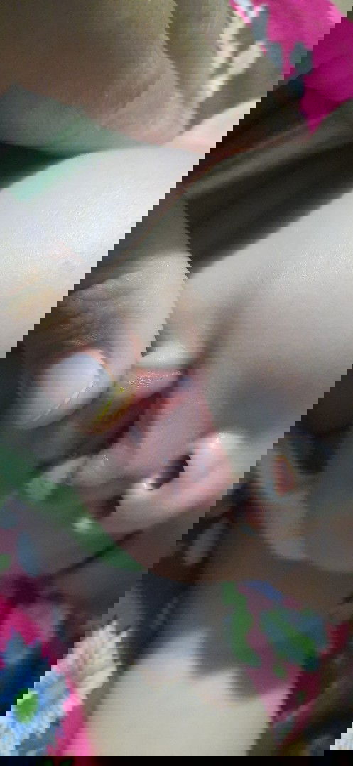 Bayi 4 bulan bagian dalam bibirnya ada bintik-bintik merah