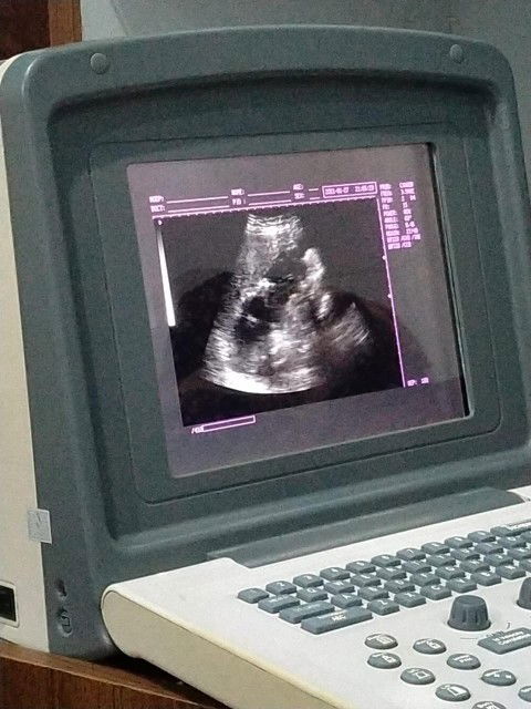 Dag dig dug menjelang HPL