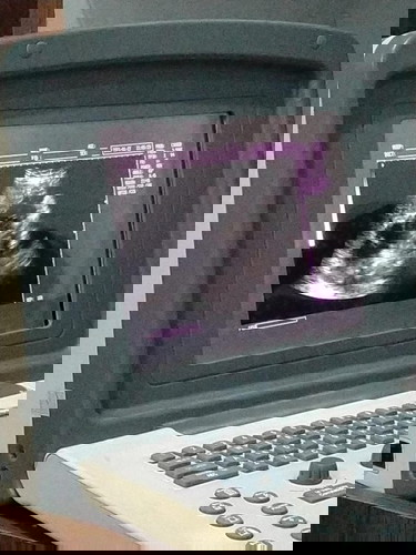 Dag dig dug menjelang HPL