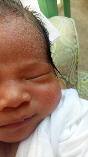 Hello mga mommy's,itatanung ko lang anong gamot po kaya sa baby ko narashes po ata. Thank you po.