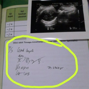 Posisi kepala baby