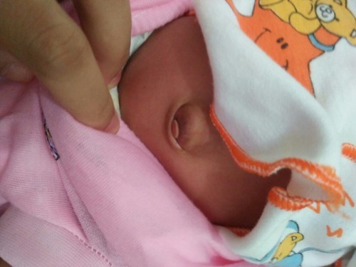 Udel anak.