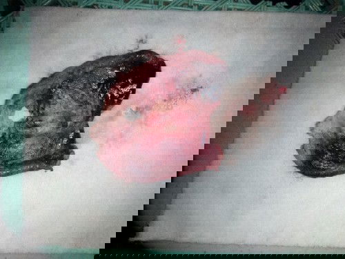 Ano po kaya ito? Advice please