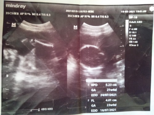 BINGUNG BACA HASIL USG 2D