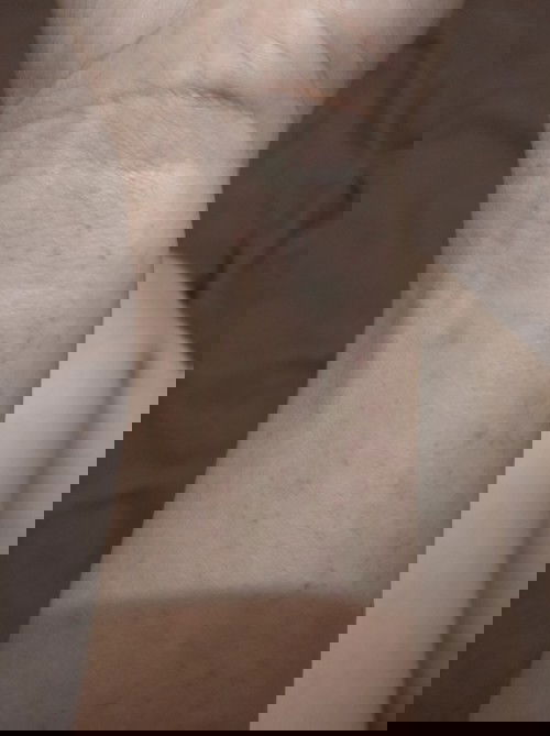 Ada yg pernah bintik2 ruam saat hamil 7bulan?