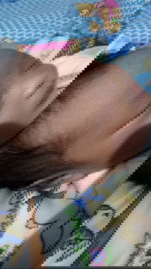 Biang keringat / ruan susu