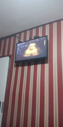 Ingin bertanya seputar kehamilan