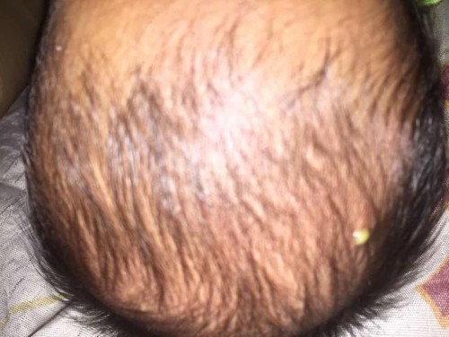 Masalah pada kulit Newborn