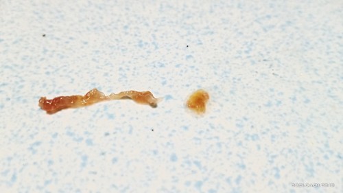 MUCUS PLUG NA PO BA ITO?