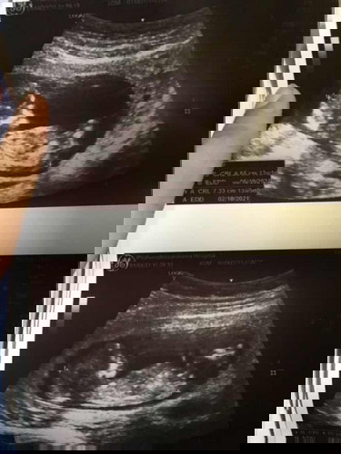 #ลูกคนแรก #ไอแฝดของแม่💕