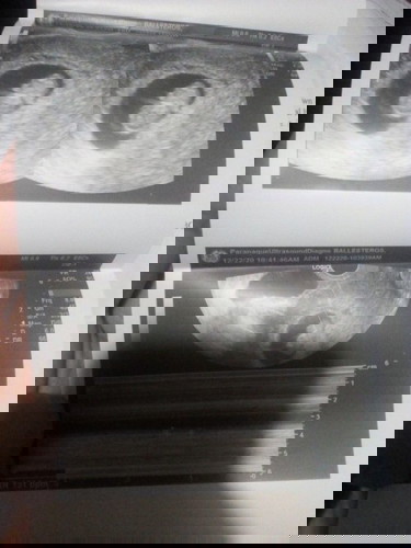 Ano po magandang gawin sa sinisikmura hindi ako makainom ng gamot dahil buntis ako. Salamat po