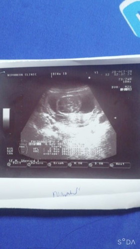 16สัปดาห์ค่ะ แต่ดูไม่ออกเลย