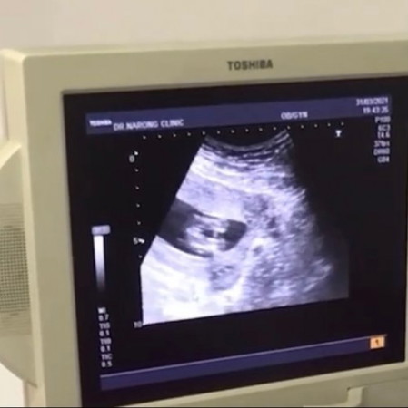 🤰🏻🤰🏻ใครเคยมีลูกสาวช่วยดูหน่อยค่ะ