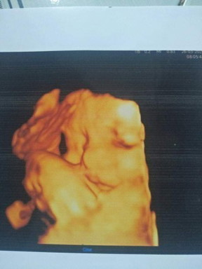 33w 1kg9 đủ cân nặng không m.n.