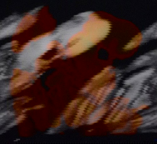 Berat bayi berlebih dari usia kandungan