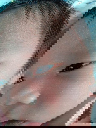 ลูกตาแฉะทำใงคะ