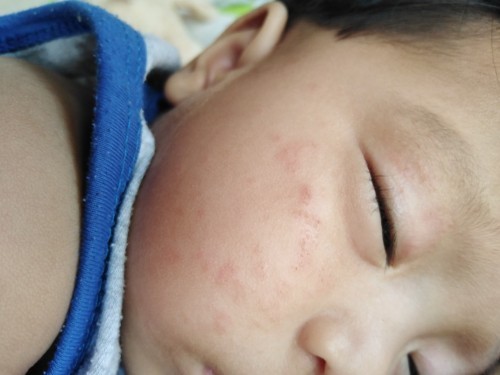 รบกวนสอบถามหน้าน้องเป็นอะไรคะ