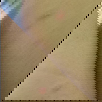 Bintik bintik berair