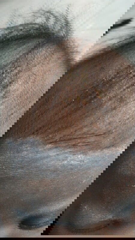 Kepala anak berkerak