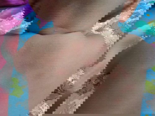 Biang Keringat atau bukan?