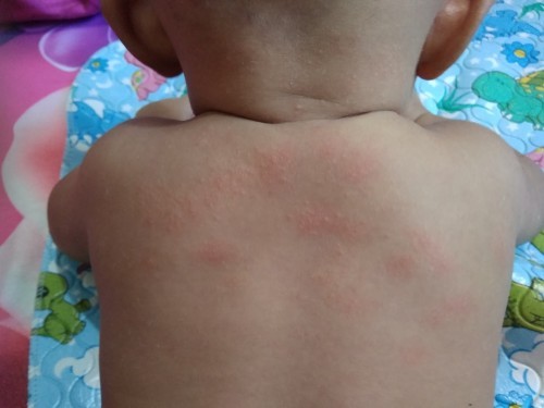 Biang Keringat atau bukan?