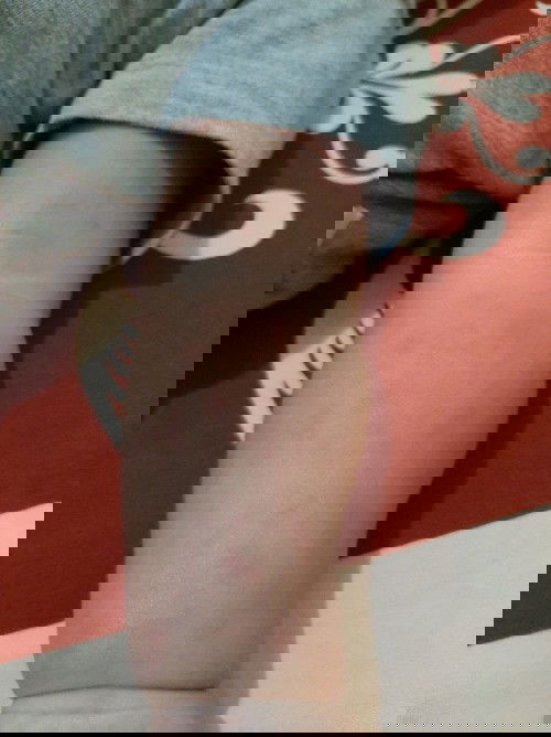 kulit bayi kemerah merahan