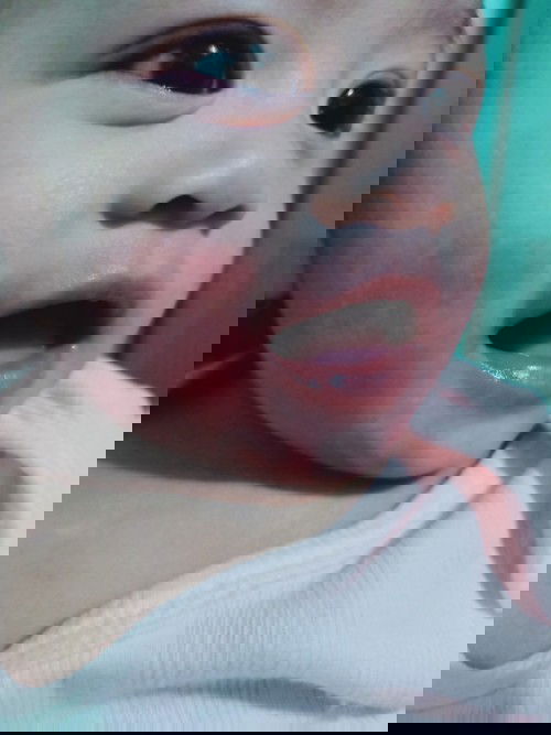 mommy ask lang po kong ano po pwede ii lagay sa face ni baby ko 4month old subrang namumula po kasi?