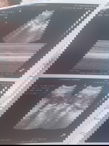 Sana po masagot nag aalala Lang poko.