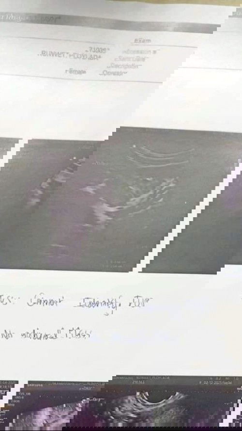 ท้อง 5 week ไปซาว ไม่พบคะ. เป็นเพราะอะไรคะ.