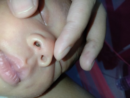 แม่ทานไหนมีปัญหาเรื่องขี้มูกบ้าง