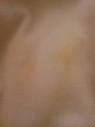 Dugo sa lampin ni baby