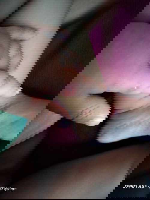 Benjolan ditangan dan kaki