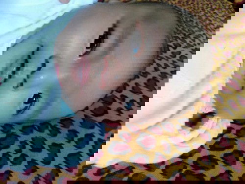 bercak putih pada bayi