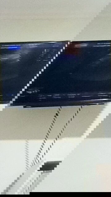 Hamil tapi ada kista