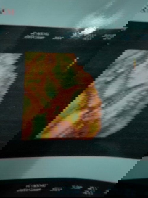 E bị nhau mặt sau có s k ạ