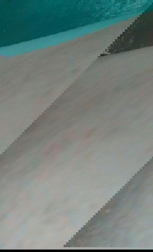 Maaf mau nanya nih bun ne kenapa ya bintik2 merah kaya gini di saat hamil 4 bulan