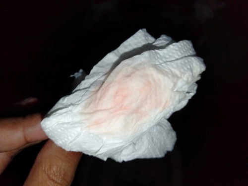 Anu po kaya ito...40 weeks and 4 days..