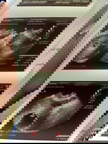 Gandang gabi po mga inay, 8 weeks, 4 days preggy. Pang 3 anak ko na ito..