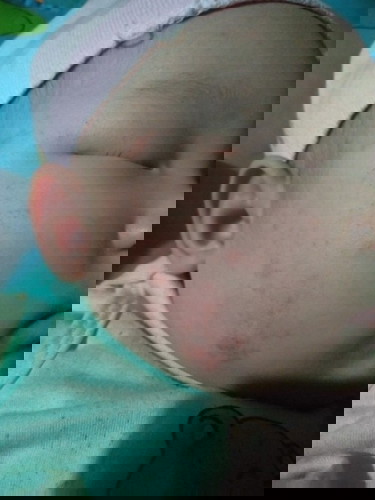 Các mon ơi cho e hỏi bị như thế này là bị gì ạ=\=\