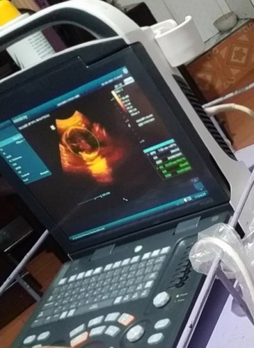 Semoga Allah karuniakan anak ke 2 ku cowok. Aamiin ya Allah 🙏