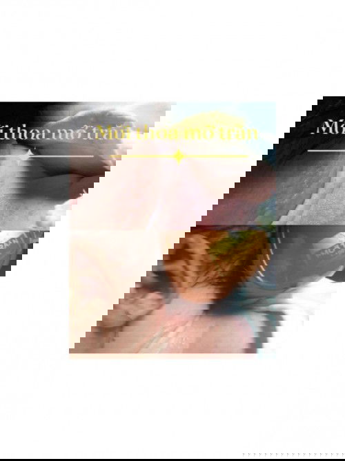 Trị hăm tã, viêm da ở trẻ