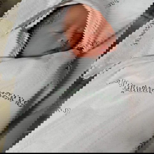 แรกเกิดกับปัจจุบันหมาน้อยที่หน้าตาเปลี่ยนไปไม่เหมือนแม่เลยได้พ่อมาทั้งนั้นต้าวเด็กอ้วง